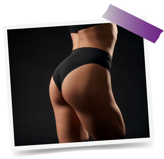 Butt Augmentation In Dubai