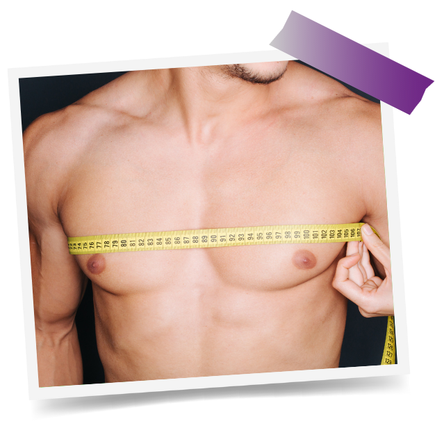 Gynecomastia In Dubai