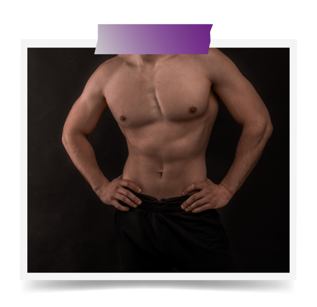 Gynecomastia In Dubai