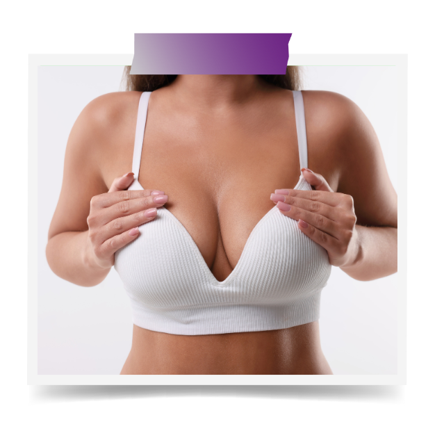 Breast Augmentation with Implant