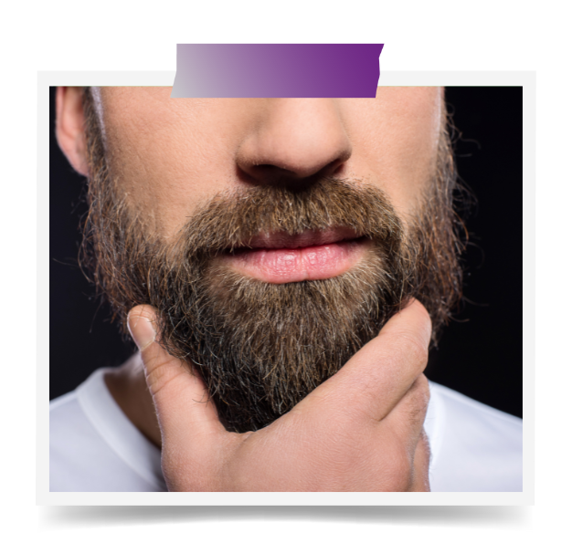 Beard Transplant In Dubai