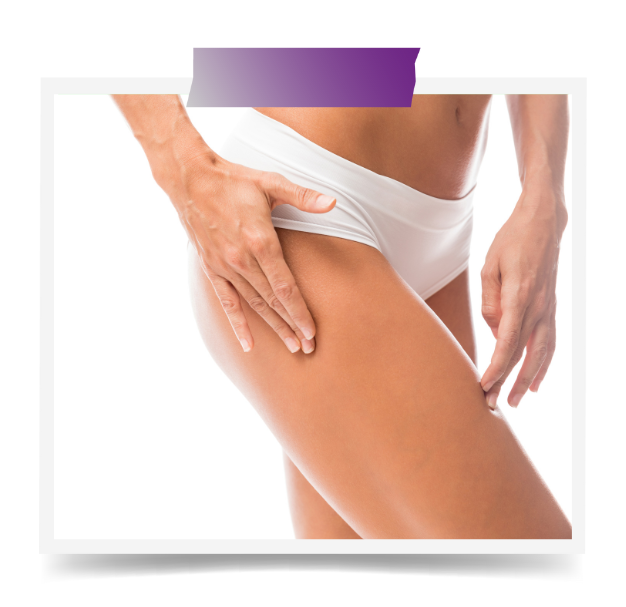 Thigh Liposuction In Dubai