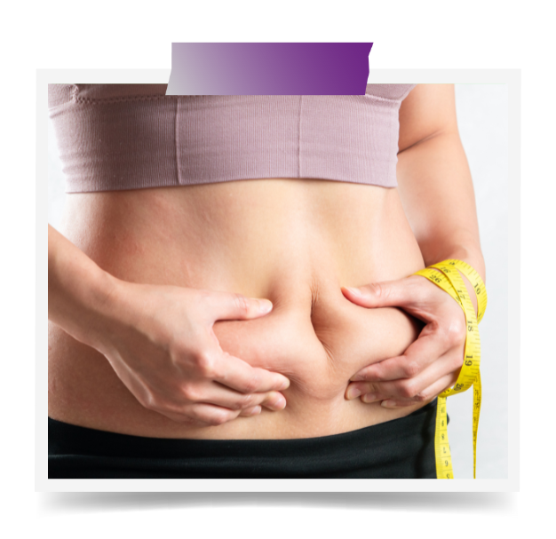 Mini Abdominoplasty In Dubai