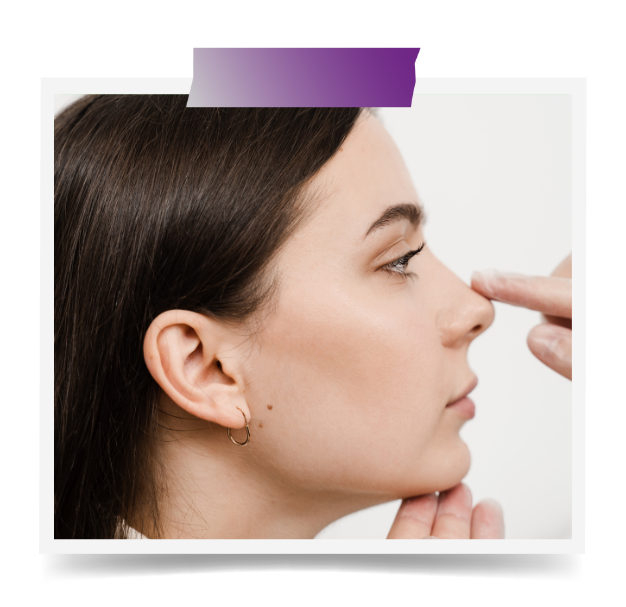 Rhinoplasty In Dubai