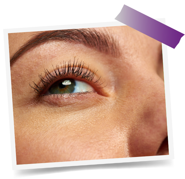 Blepharoplasty In Dubai